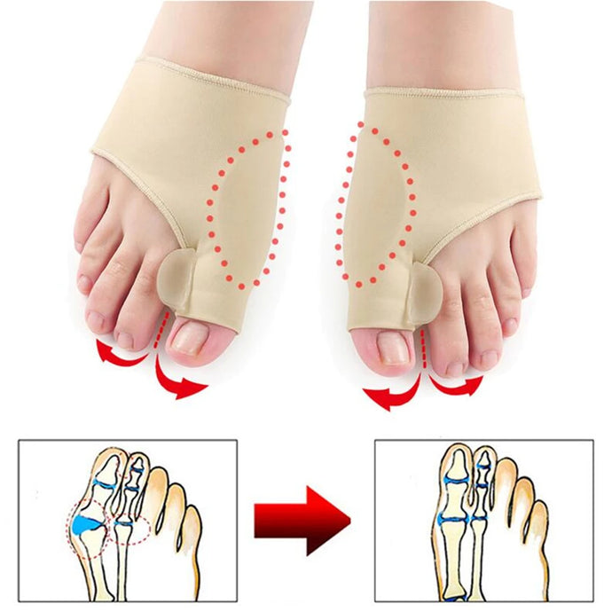 Correcteur hallux valgus orteils