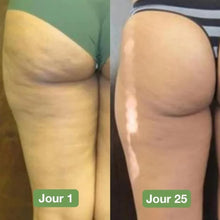 Appareil masseur anti-cellulite pro SONIBLUE