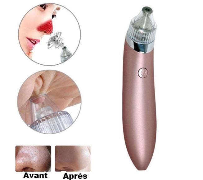 Aspirateur Points Noirs Pro™ – Nettoyage Profond des Pores